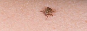 Lyme Borreliose